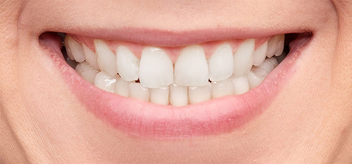 close up of white teeth